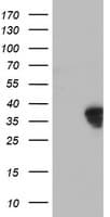 Monoclonal Mouse anti-Human HOXC11 Antibody (clone OTI3E5, IF, WB)
