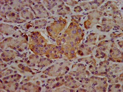 HPN / TMPRSS1 / Hepsin Antibody