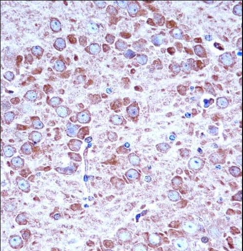 AAK1 Antibody (aa279-306)