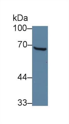 TFB1 / GTF2H1 Antibody (aa84-335)