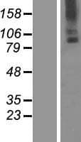 Human TMC6 Protein (Over-Expression Lysate Myc-DDK (Flag))