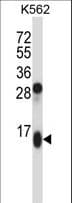 GUCA2A / Guanylin Antibody (aa25-54)