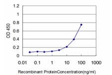 IHC-plus™ Monoclonal Mouse anti-Human HSPB8 / H11 / HSP22 Antibody (clone 5B12, IHC, WB)