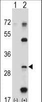 Polyclonal Rabbit anti-Human PSMB5 Antibody (aa235-263, IHC, WB)