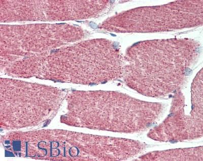 IHC-plus™ NEDD4 Antibody (aa825-875)