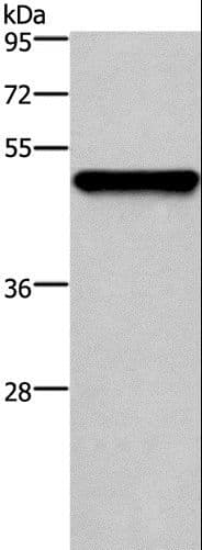 Polyclonal Rabbit anti-Human KRT14 / CK14 / Cytokeratin 14 Antibody (IHC, WB)