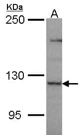 Polyclonal Rabbit anti-Human PLEKHG4 Antibody (aa35-256, WB)