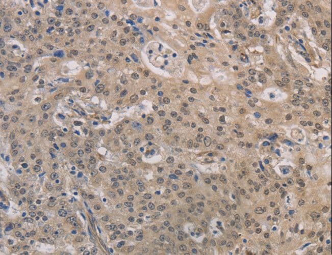 DPYSL3 / CRMP4 Antibody
