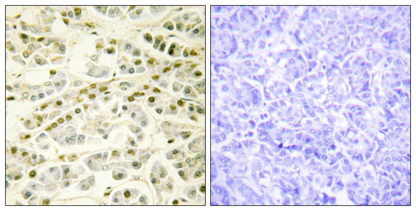 RAD51B Antibody
