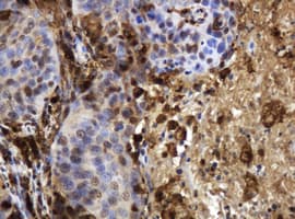 TP / Thymidine Phosphorylase Antibody (clone OTI1H7)