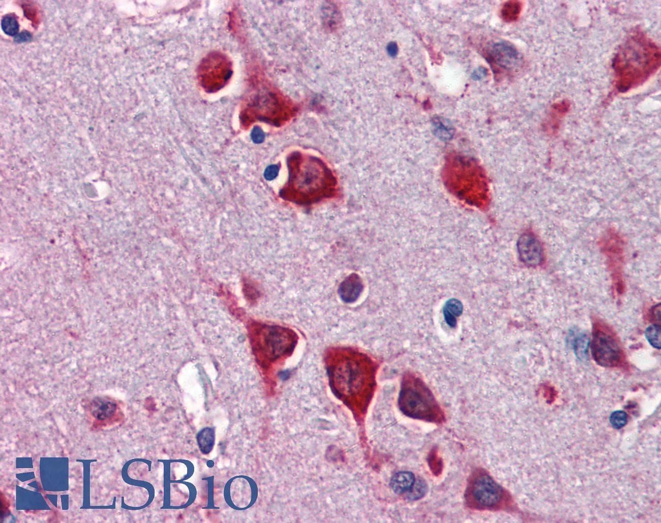 TBX5 Antibody (aa174-223)