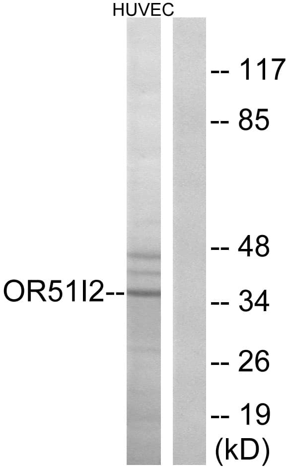 Polyclonal Rabbit anti-Human OR51I2 Antibody (aa201-250, WB)