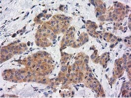 KCTD14 Antibody (clone OTI1D11)