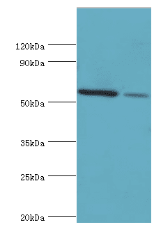 Polyclonal Rabbit anti-Human ADSL / Adenylosuccinate Lyase Antibody (aa1-310, IHC, WB)