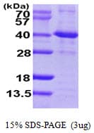 Human SIRT2 / Sirtuin 2 Protein (Recombinant His)
