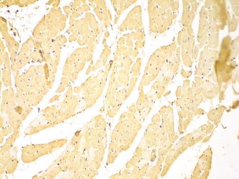 BIRC2 / cIAP1 Antibody