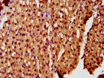 Polyclonal Rabbit anti-Human ZKSCAN5 Antibody (IHC)