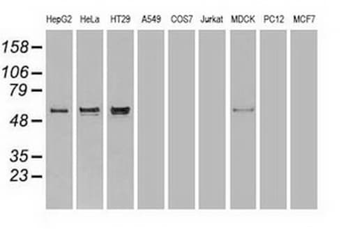 Alpha-Fetoprotein Antibody (aa19-397, clone OTI3F1)