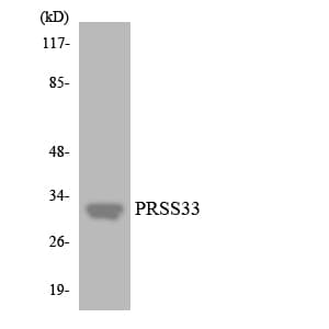 Polyclonal Rabbit anti-Human PRSS33 Antibody (aa1-50, WB)