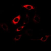 Polyclonal Rabbit anti-Human HPD Antibody (IHC, IF, WB)