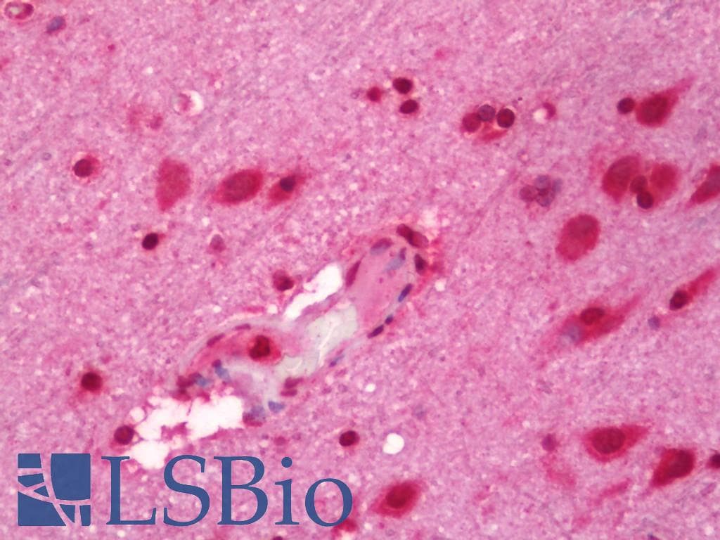 IHC-plus™ Polyclonal Rabbit anti-Human RPS19 / Ribosomal Protein S19 Antibody (aa81-130, IHC, WB)