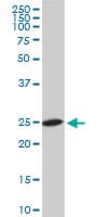 RPL19 / Ribosomal Protein L19 Antibody (clone 3H4)