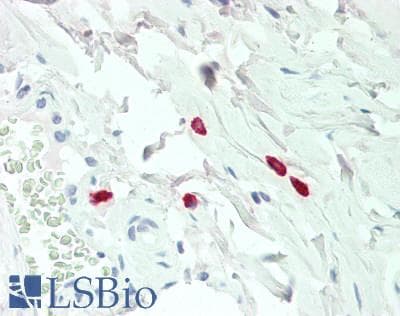 Histamine Antibody