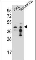 PCYT1A / CCT Alpha Antibody (aa27-54)