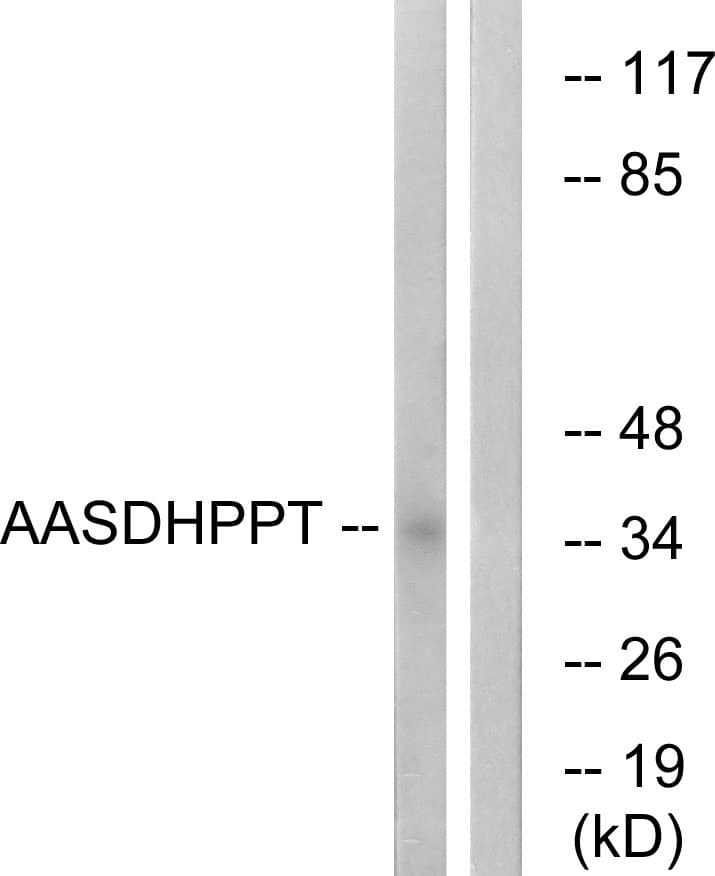 AASDHPPT / LYS5 Antibody (aa11-60)