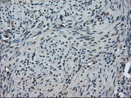 TMEM100 Antibody (clone OTI1F8)