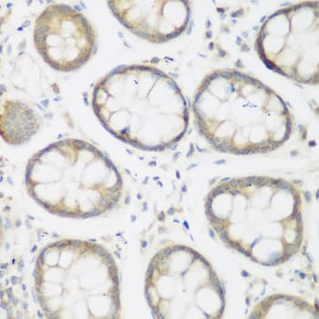 NFU1 Antibody