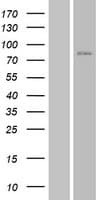 JPH3 Protein (Over-Expression Lysate Myc-DDK (Flag))