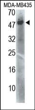 Polyclonal Rabbit anti-Human PDK4 Antibody (WB)
