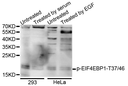 EIF4EBP1 / 4EBP1 Antibody (phospho-Thr37/46)
