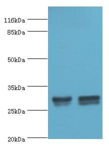 HLA-DRB1 Antibody (aa30-266, HRP)