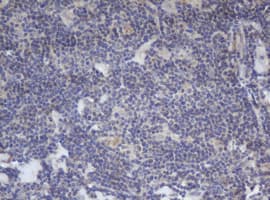Monoclonal Mouse anti-Human BCL10 / BCL-10 Antibody (clone OTI6A8, IHC, WB)