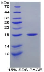 Mouse LYZ / Lysozyme Protein (Recombinant His, N-Terminal)