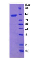 Human BRUCE / BIRC6 Protein (Recombinant His, N-Terminal)