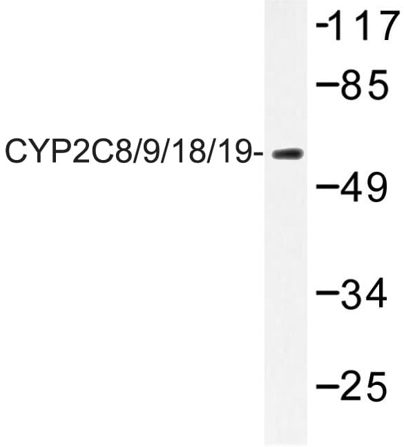 CYP2C8+9+18+19 Antibody (Met136)
