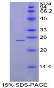 Rat MEPE Protein (Recombinant His-T7)