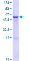 Human GLT1D1 Protein (Recombinant GST)