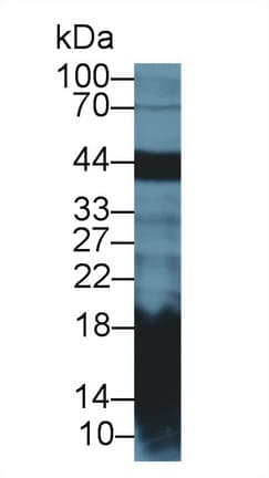REG1A Antibody (aa22-165)
