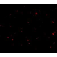 IHC-plus™ AAK1 Antibody