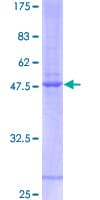 Human IFNA21 / Interferon Alpha 21 Protein (Recombinant GST)