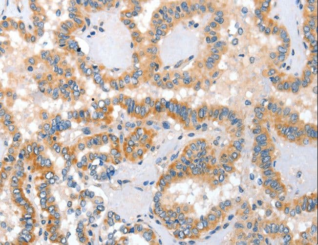 PLAP / Alkaline Phosphatase Antibody