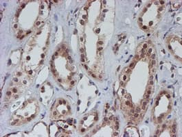 ATRIP Antibody (clone OTI5E7)