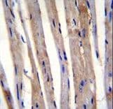 KRT73 / Keratin 73 Antibody (aa493-522)