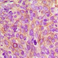 Polyclonal Rabbit anti-Human CEP55 Antibody (IHC, WB)