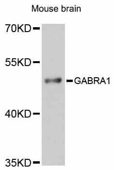 Polyclonal Rabbit anti-Human GABRA1 Antibody (WB)