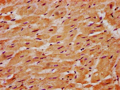 Polyclonal Rabbit anti-Human SGCG / Gamma-Sarcoglycan Antibody (IHC, IF)